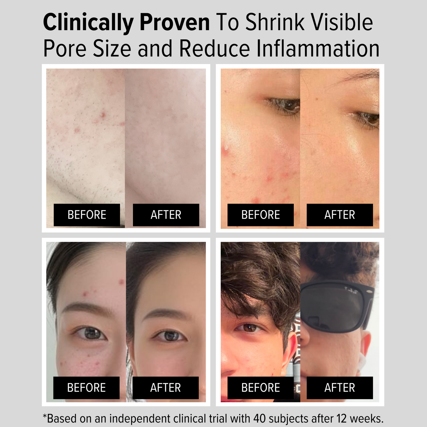 Niacinamide 10% Serum with Hyaluronic Acid