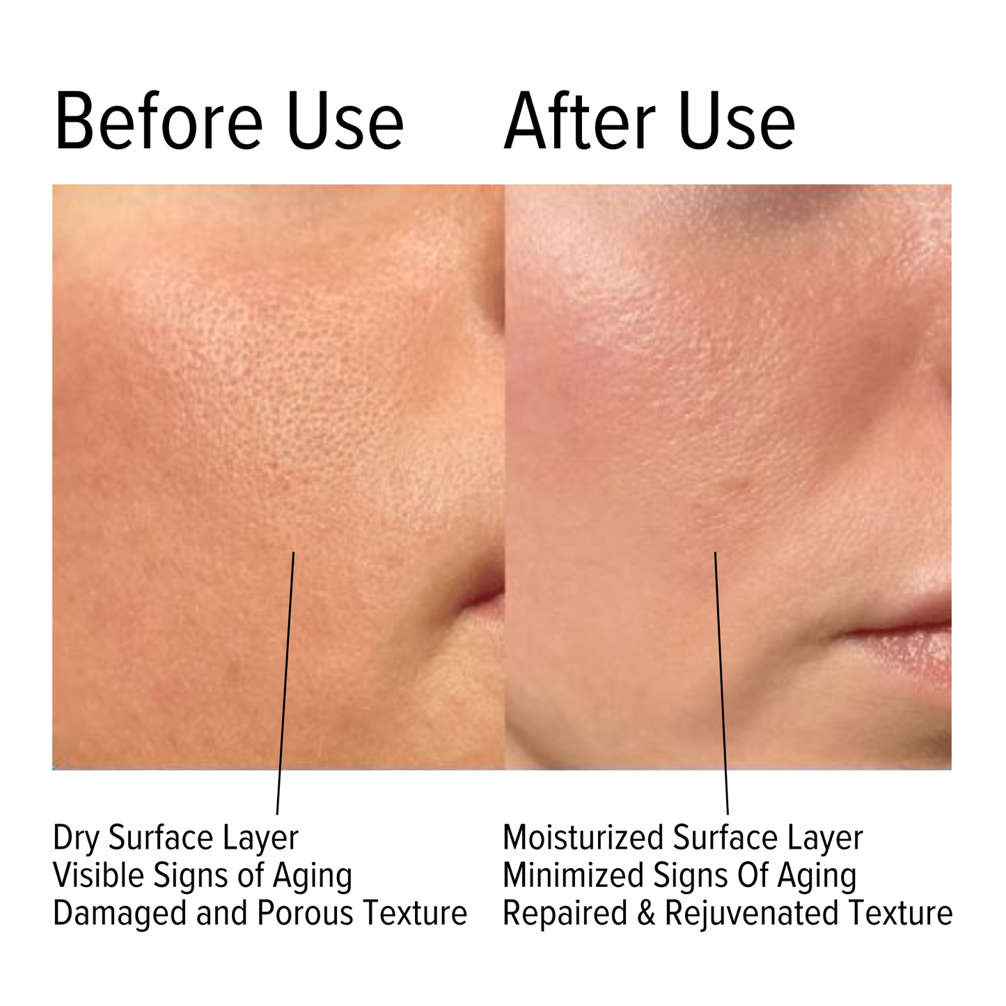 Skin Hydrating Cream With Hyaluronic Acid