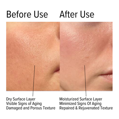 Skin Hydrating Cream With Hyaluronic Acid